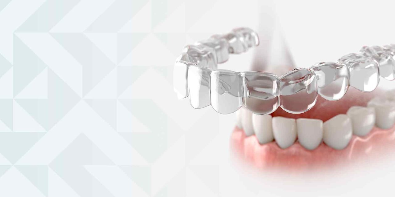 2025: Ring In The New Year With Invisalign Clear Aligners
