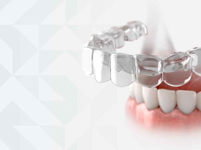 2025: Ring In The New Year With Invisalign Clear Aligners
