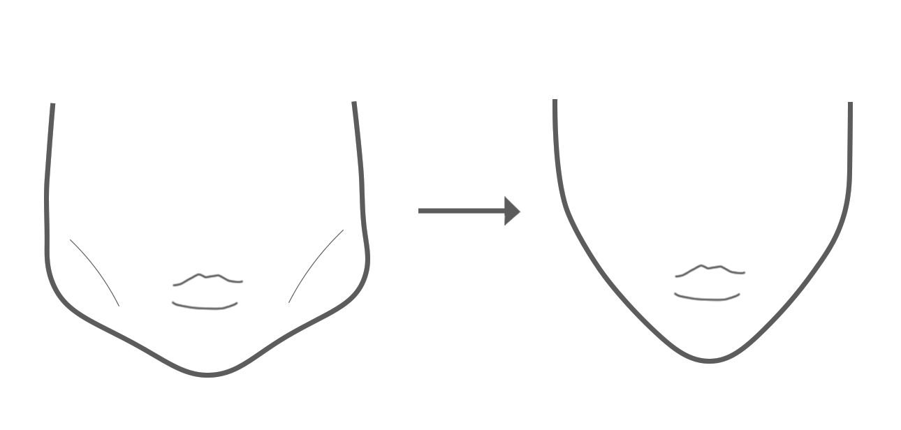 https://dentistmillvalley.com/wp-content/uploads/2023/12/face-slimming.jpg