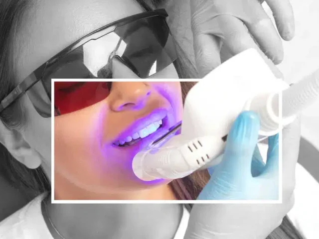 Teeth Whitening: Brighten Your Smile and Your Day