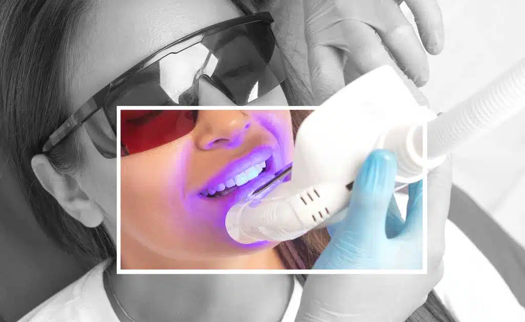 Teeth Whitening: Brighten Your Smile and Your Day