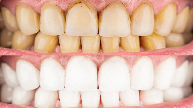 The Dangers of Using Tobacco Products